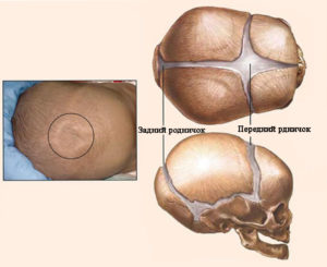 Мягкие кости черепа у новорожденных