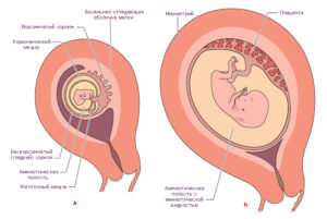 Локализация хориона по передней стенке что это значит