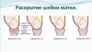 Сколько должно быть открытие шейки матки при родах