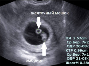 Когда появляется эмбрион в плодном яйце на узи