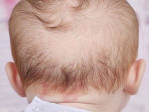 Почему выпадают волосы у новорожденных
