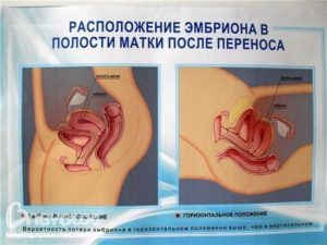 После переноса эмбрионов месячные