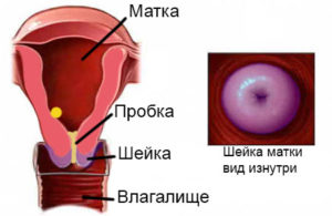 Цвет шейки матки при беременности на ранних сроках