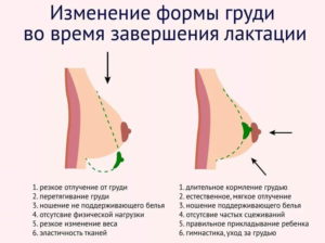 Исчезла грудь после кормления