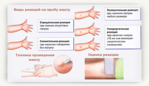 Забыли проверить манту что делать