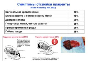 Причины отслойки плаценты на поздних сроках беременности форум