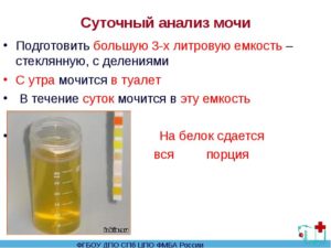 Суточный сбор мочи для анализа при беременности