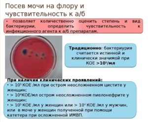 Посев на стерильность мочи