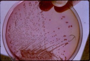 Faecalis enterococcus при беременности