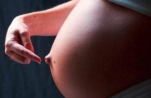 Почему во время беременности колит пупок