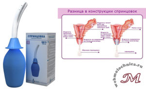 Спринцевание при беременности мирамистином