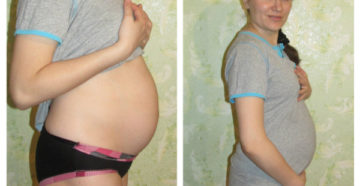 Тянет живот при беременности на 23 неделе беременности