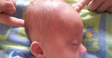Почему большая голова у новорожденного