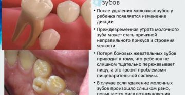 Раннее удаление молочных зубов последствия