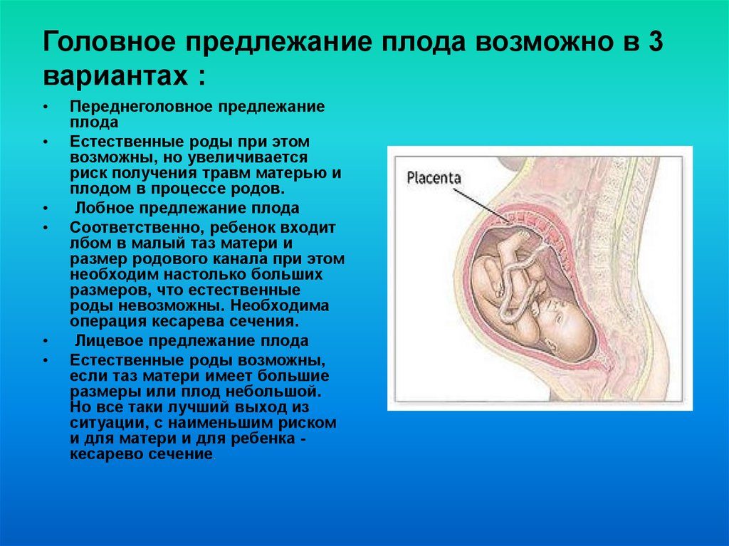 Головное предлежание плода что это значит 30 недель