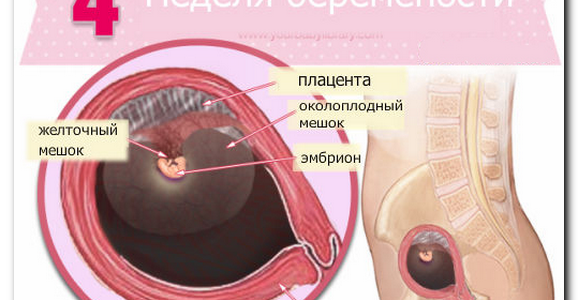 Место прикрепления эмбриона в матке. Местоприкрепоения эмбриона в матке. Матка на 4 неделе беременности.