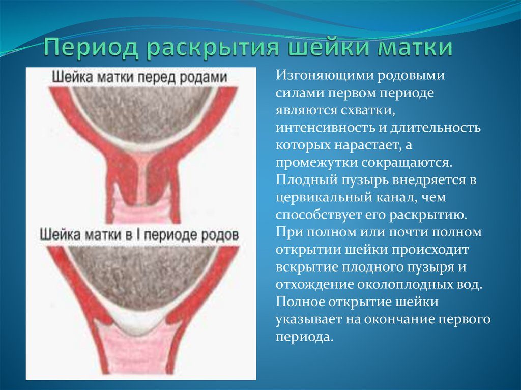 Что способствует раскрытию шейки матки