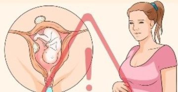 Чем подмываться во время беременности при молочнице